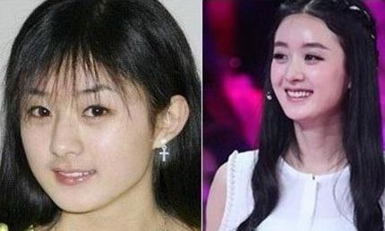 整容明星对比，科技重塑美丽，重塑生活风采